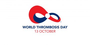 ‘El 13 d’octubre, Dia Mundial de la Trombosi’, per Brian Cutts