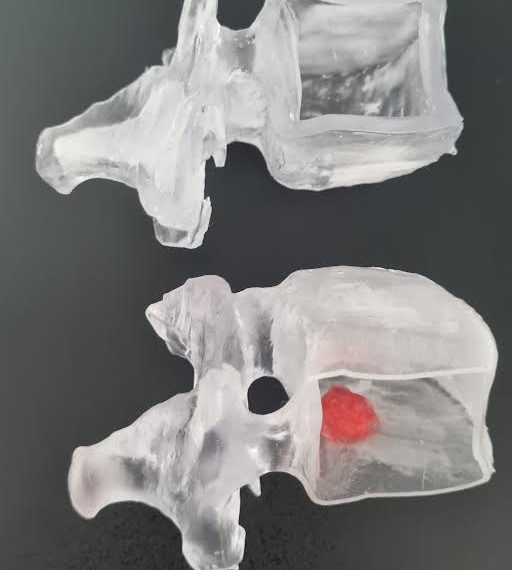 L’hospital de Tortosa simula cirurgies complexes amb el Laboratori 3D Atmosfera