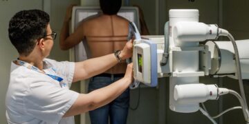 Cada any es diagnostiquen uns 600 casos de càncer de pulmó a l’Ebre i el Camp