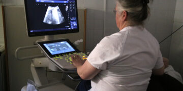 Metgesses ebrenques impulsen un estudi pioner per controlar la insuficiència cardíaca a través de l’ecografia pulmonar