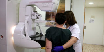 La supervivència del càncer de mama és de gairebé el 90% cinc anys després del diagnòstic